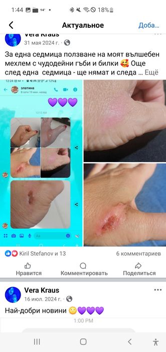 Мехлем против Хемороиди, псориазис, рани и друго...