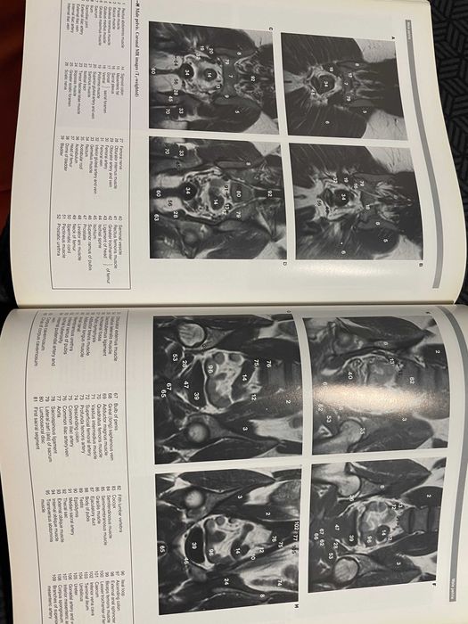 Atlas imagistic de anatomie umana Wolfe medicina rezidentiat impecabil