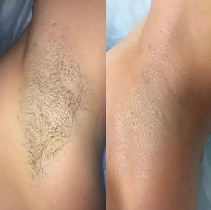 Дорогие дамы приглашаю вас на процедуры шугаринга