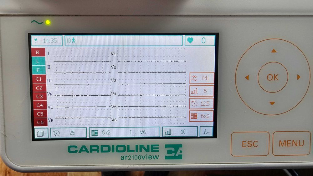 EKG Profesional Cardioline AR2100 view 12 canale electrocardiograf