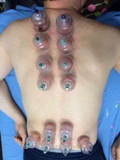 Kinetoterapie, recuperare medicala, AVC la domiciliu sau cbinet