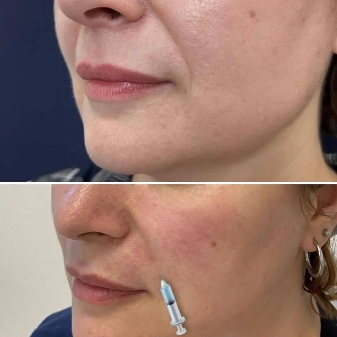 Filler quydik labga dahanga nosagubkaga