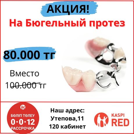 Бюгельный протез Ремонт протеза Зубной техник Стоматология Алматы