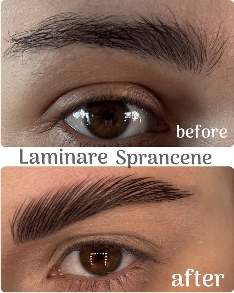Laminare gene si sprancene