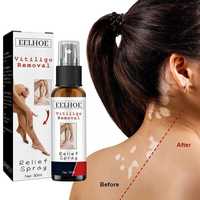 Spray Vitiligo, Spray pentru pete Vitiligo 30ml , Extras din plante