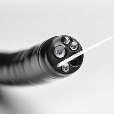 Видео Гастроскоп SonoScape