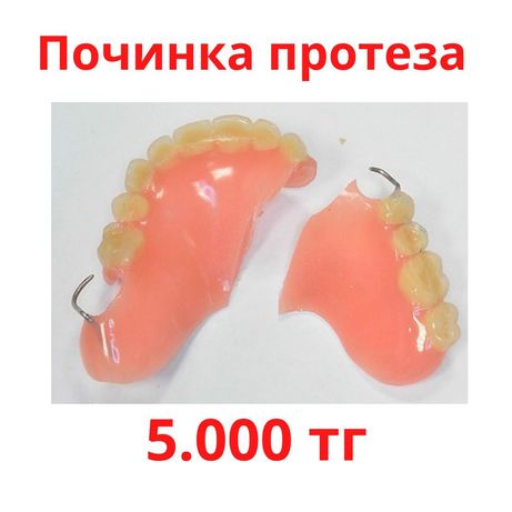 Починка протеза Ремонт протеза Зубной техник Стоматолог Алматы Имплант