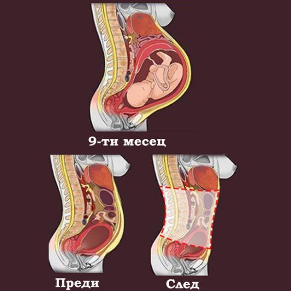 Vika Baby колан за след раждане