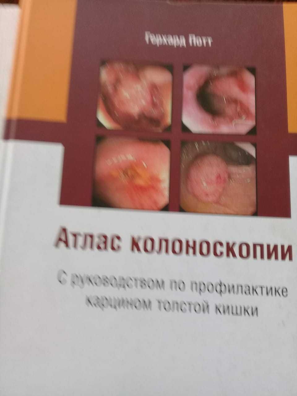 Книги по эндоскопии
