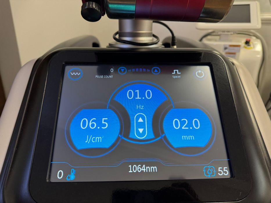Aparat laser indepartare tatuaje