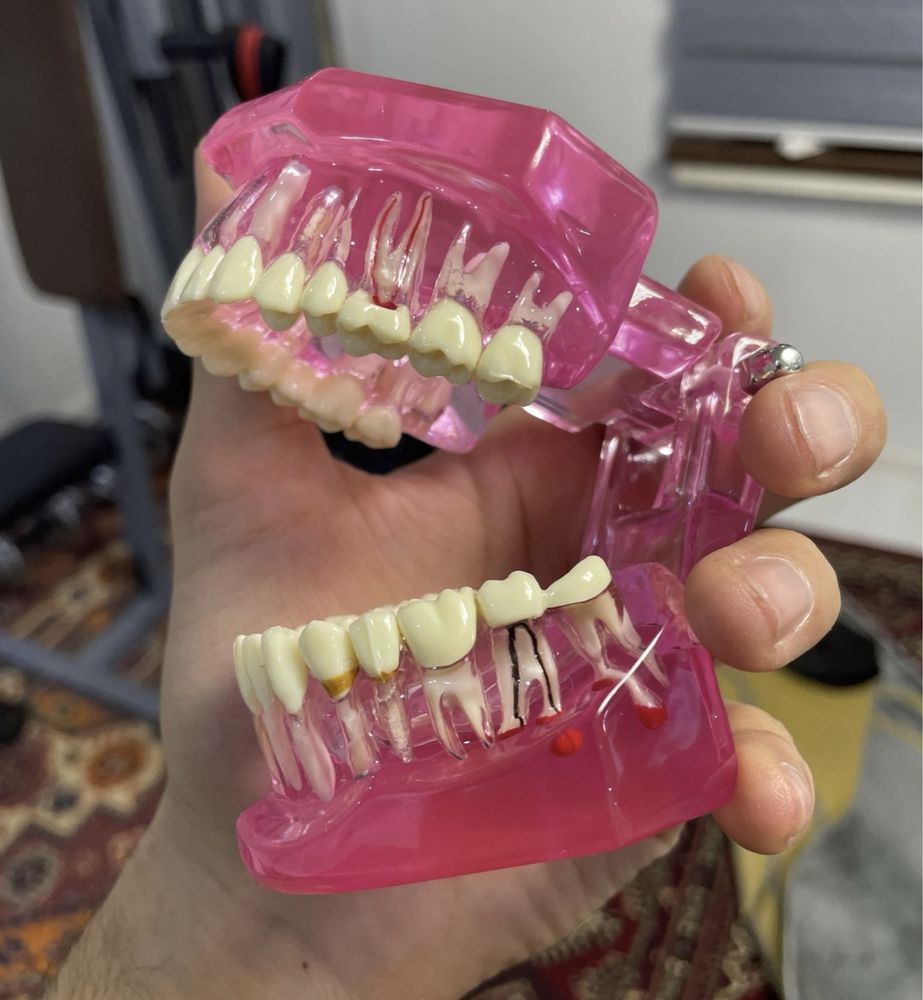 Модели для стоматологов. Модель зубов. Стоматология и хирургия
