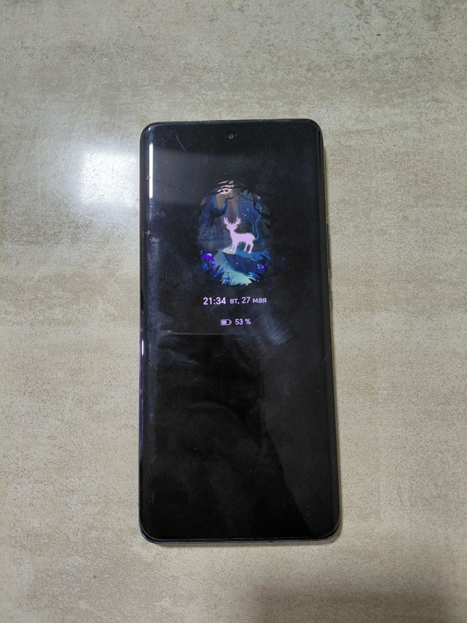 Honor x9b 5G holati yahshi