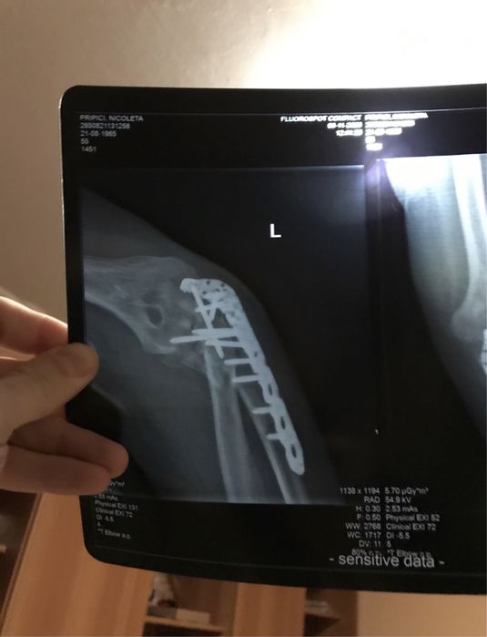 Kinetoterapie la Domiciliu