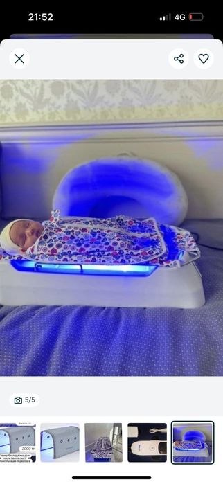 Фотолампа от желтуха.