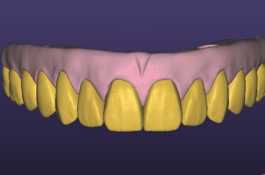 Colaborare Tehnician Dentar
