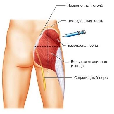 Тренировочный муляж ягодица для тренинга инекция на внутримышечно