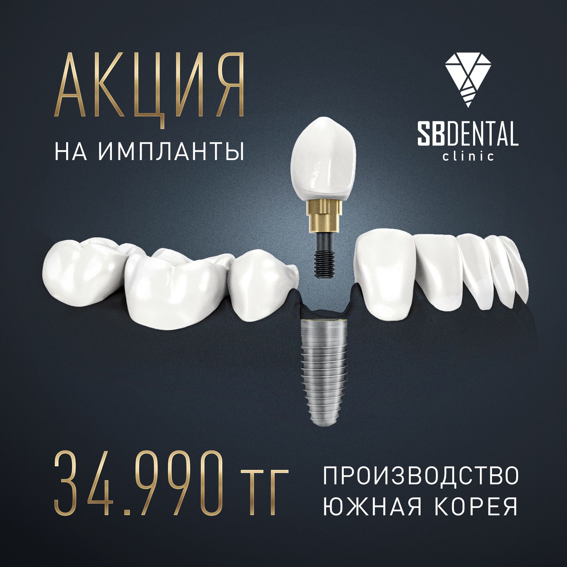 Акция на установку имплантов