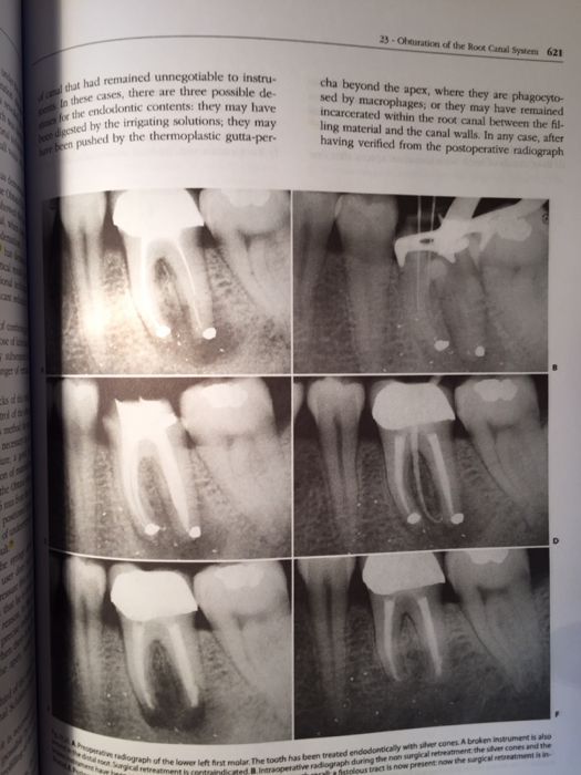 Endodontics CASTELLUCCI Vol.2 Editia 2009