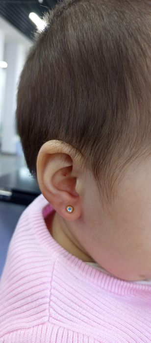 Quloq Burun teshish xizmati endi sizning xonadoningizda