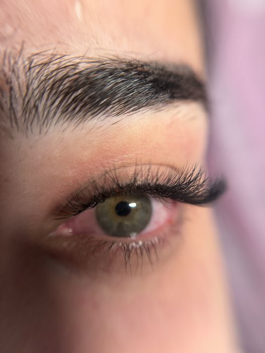 Промоция! Миглопластика и ламиниране