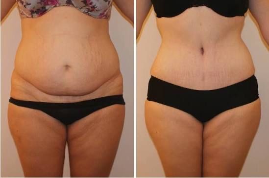 Fitcoach, Профтренир,