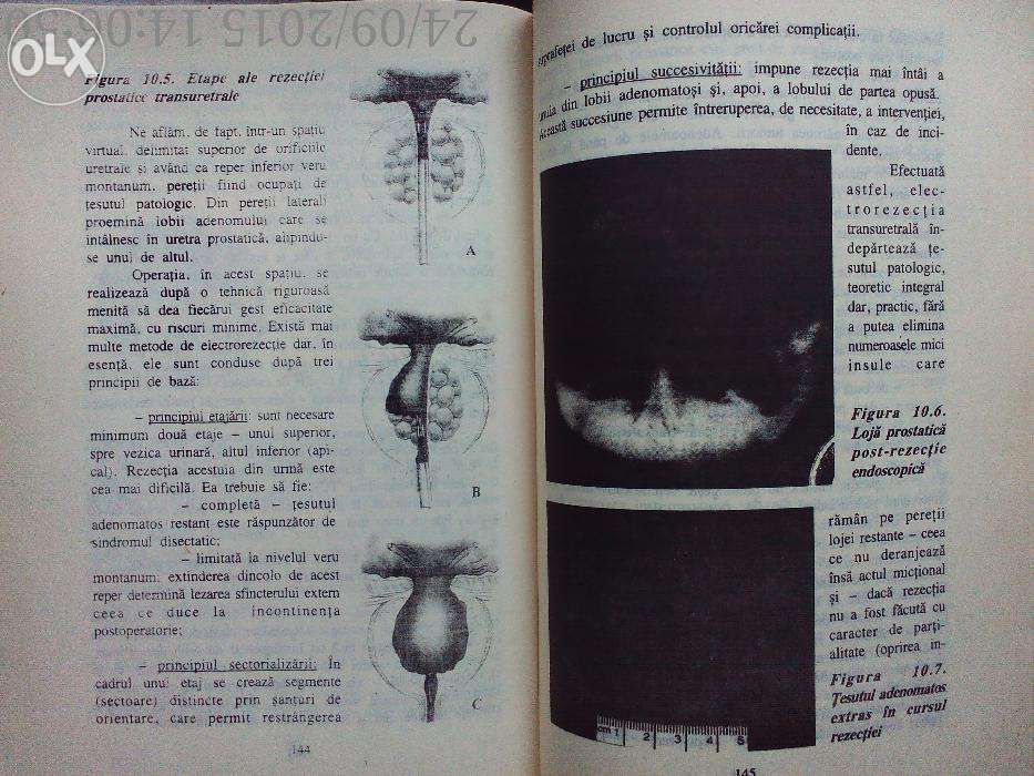 Prostata si tumorile ei , Vol. I ,Stelian Persu , Viorel Jinga