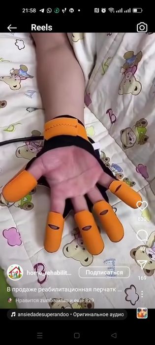 Реабилитационная перчатка после инсульта