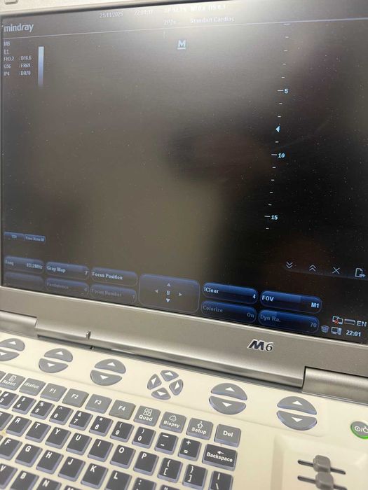 портативен ехограф - кардиологичен Mindray М6