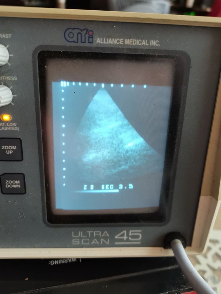 ехограф Ultra Scan 45