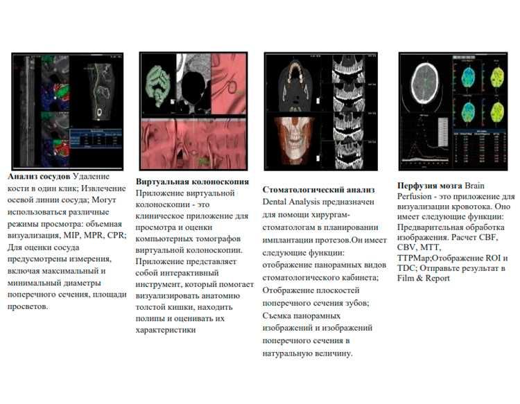 Компьютерный томограф NeuViz 64