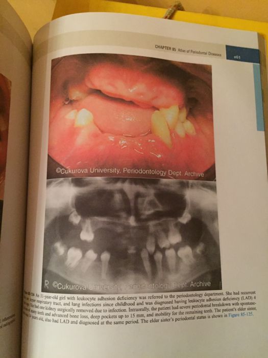 CARRANZA's Clinical Periodontology 13th edition 2018