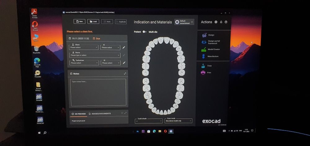 Laptop Gaming cu Exocad