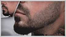 Micropigmentare barba barbati, scalp, sprancene alopecie