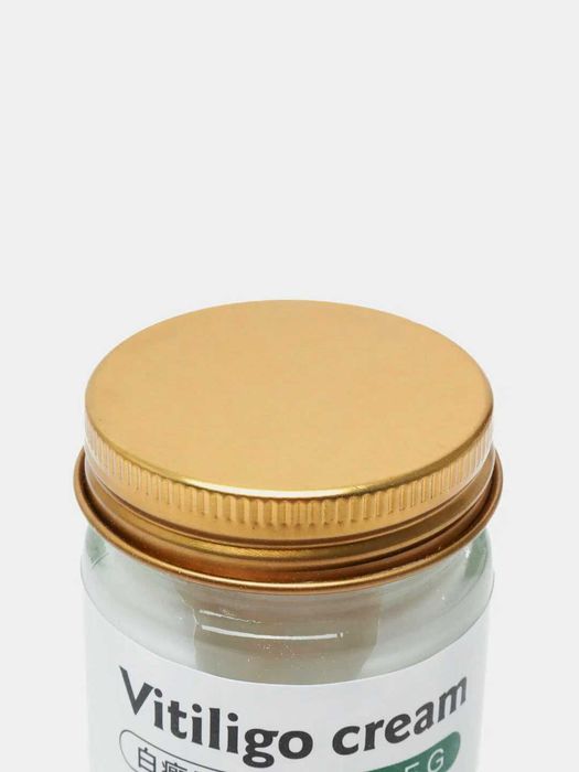 Vitiligo kremi oq doglarga qarshi
