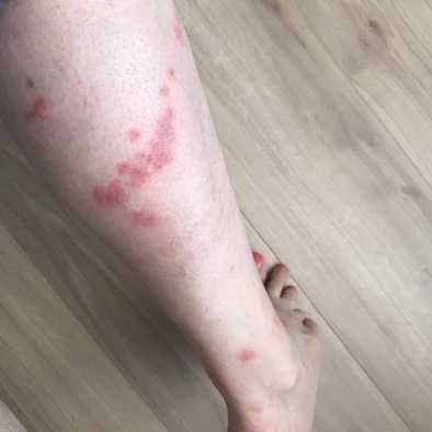 клопы, тараканы, блохи, мыши, кандала, бесплатная консультация