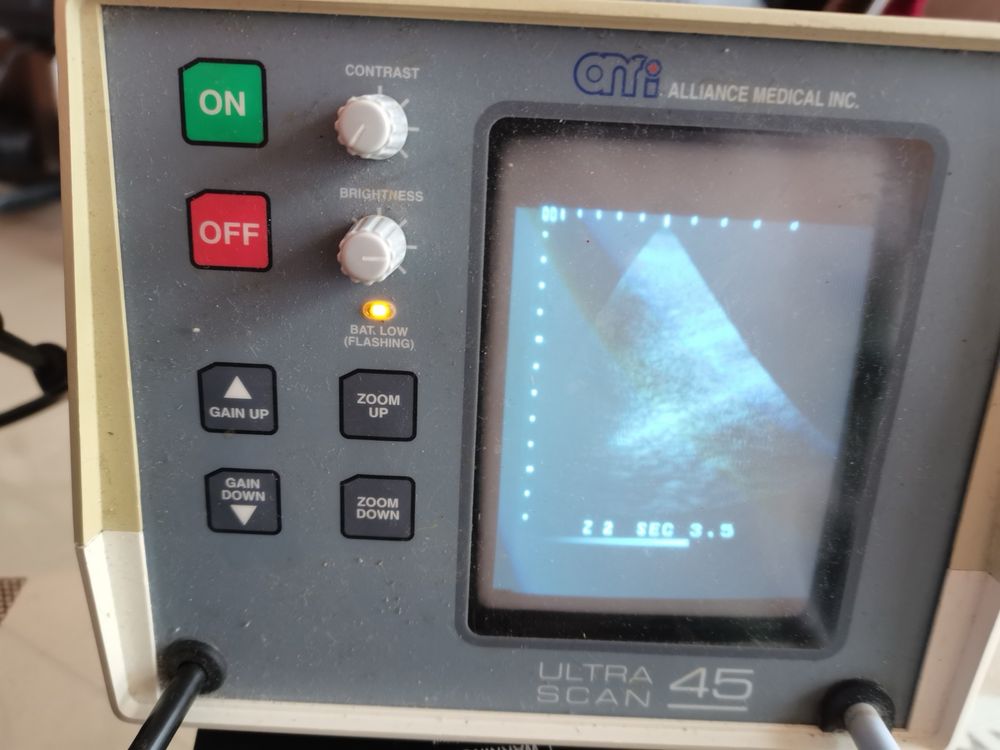 ехограф Ultra Scan 45