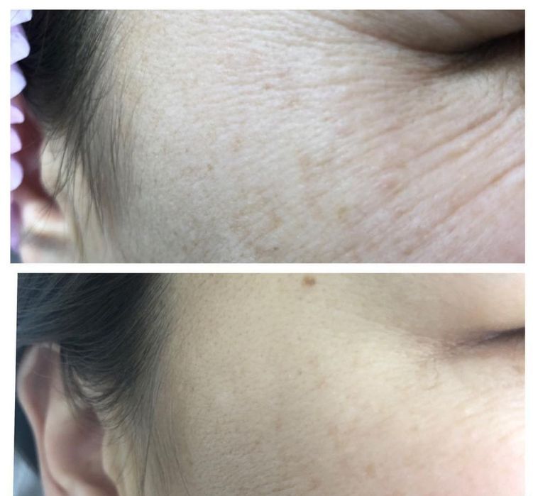 100% tabiy collagen ulitkalar sotuvda bor