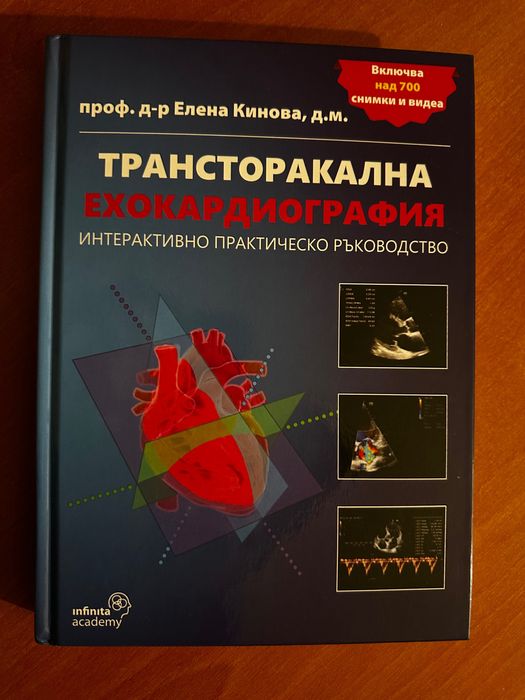 Ехография. ЕхоКГ