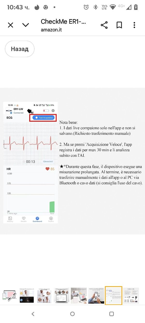 CheckMe ER1-LW 24-часов преносим ЕКГ монитор за домашна употреба, AI Е
