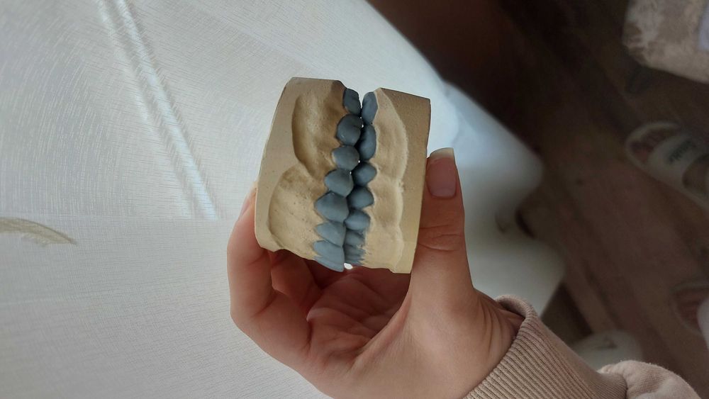 Продавам моделирани зъби 100лв