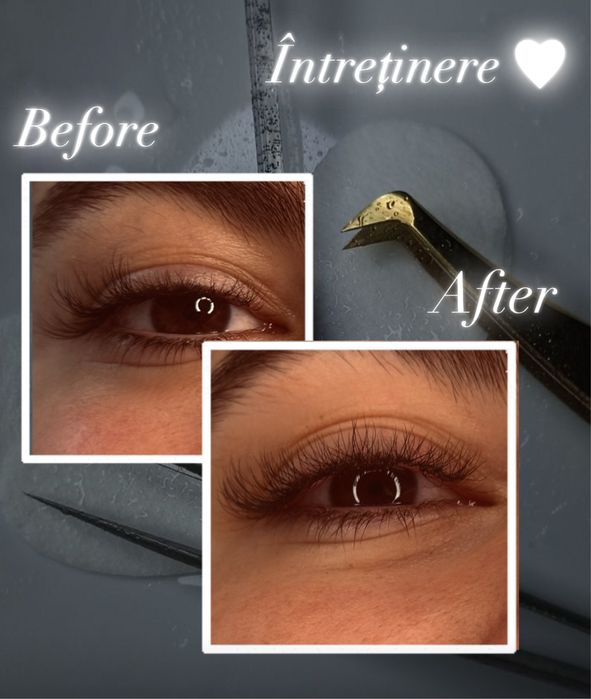 Extensii de gene in Sibiu