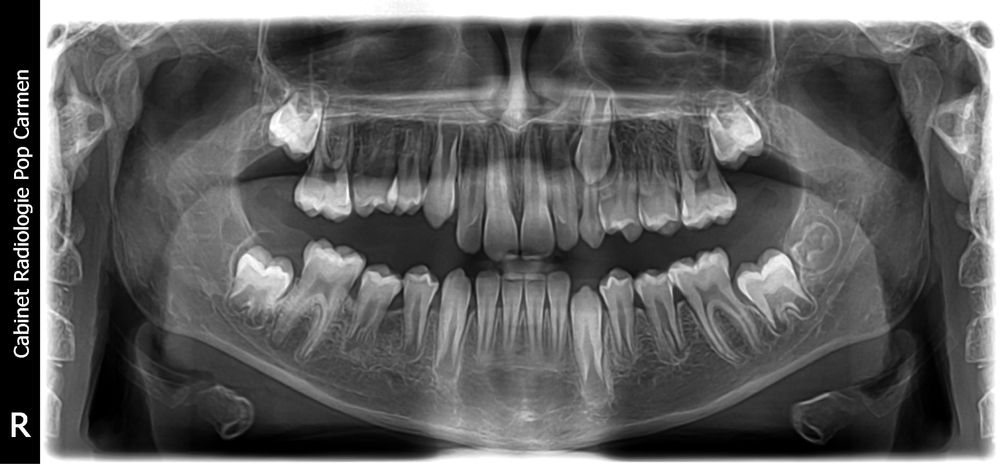 Aparatură radiologie dentară