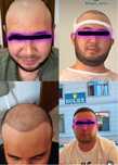 Soch Ekamiz 100% Garantiya