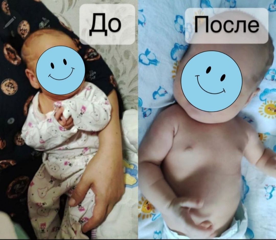 Фотолампа. Фототерапия. Fotolampa.Fototerapiya