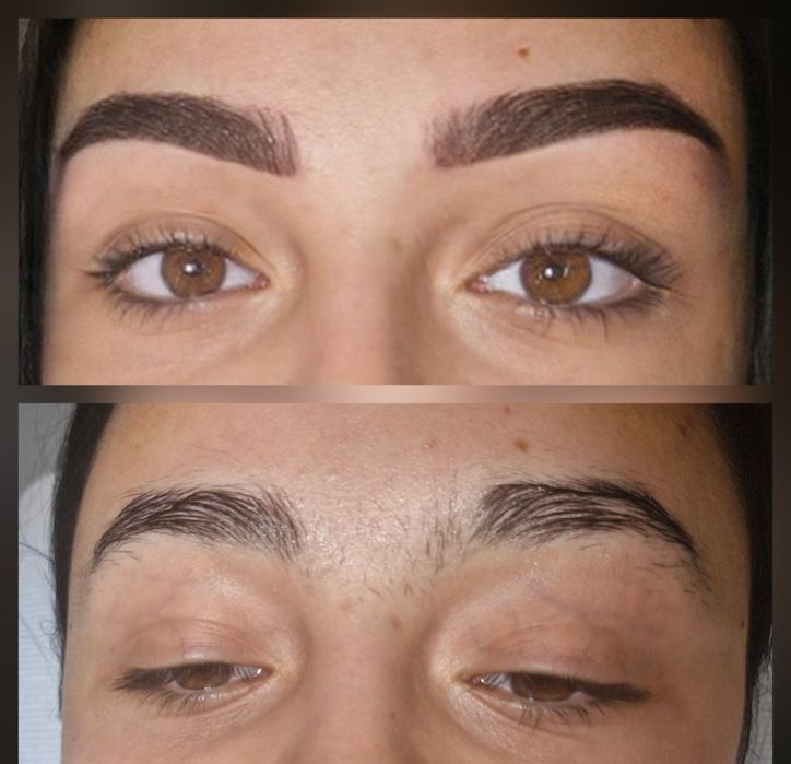 Rinoplastie, mărire buze, micropigmentare