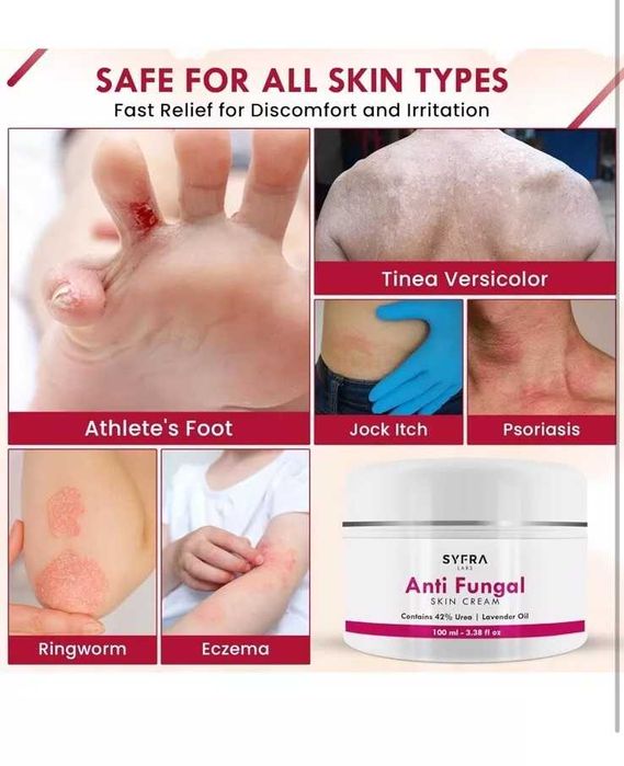 Нов Крем против гъбички с урея и лавандула за крака и нокти Лечение