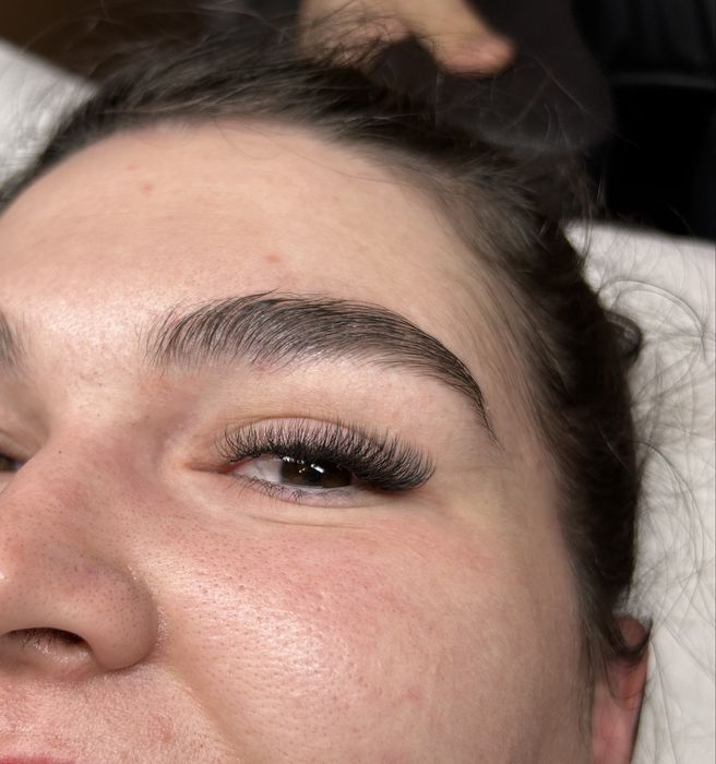 Extensii gene, zona Rogerius