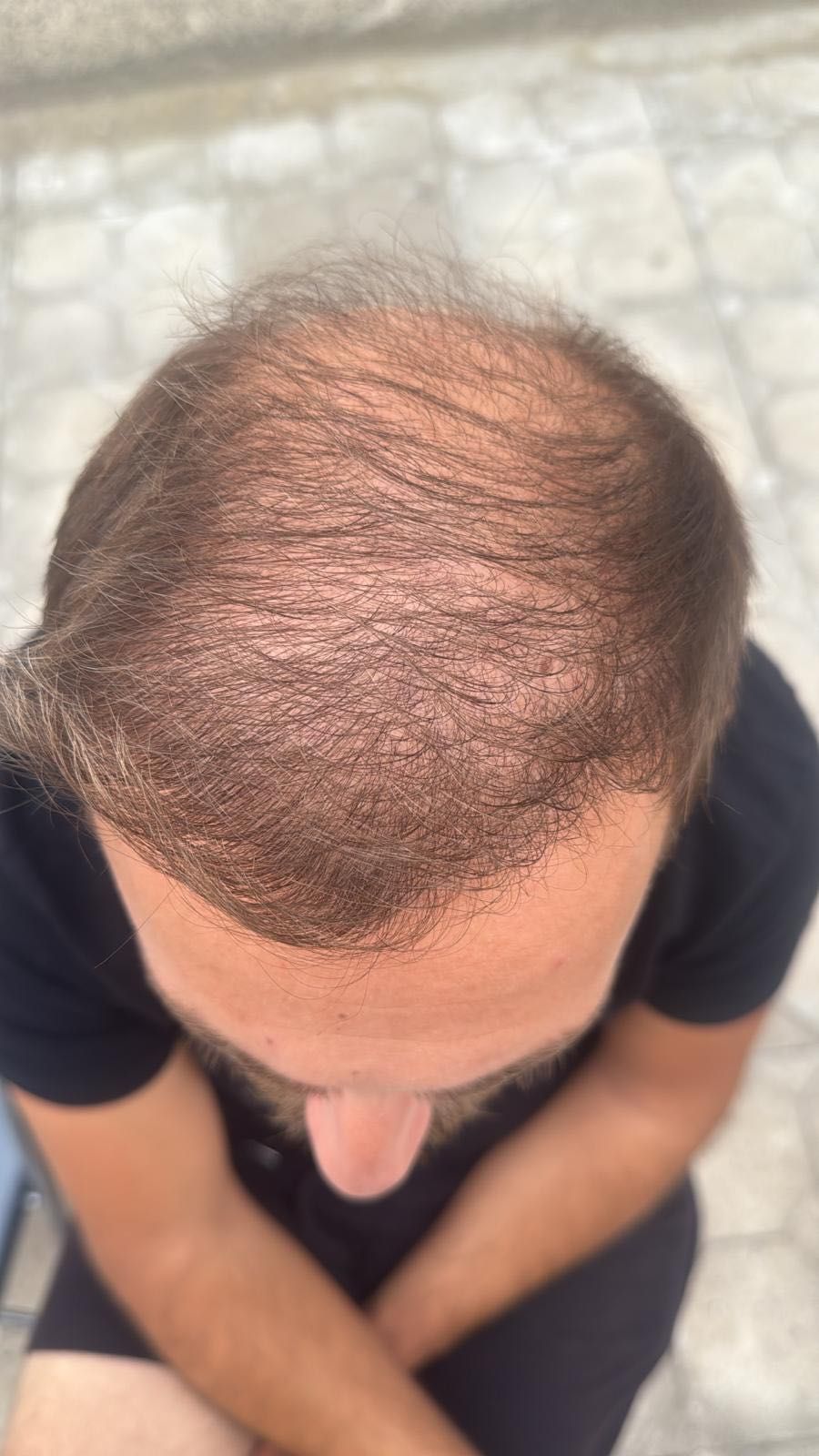 Dermanew Hair грижа за здрава коса