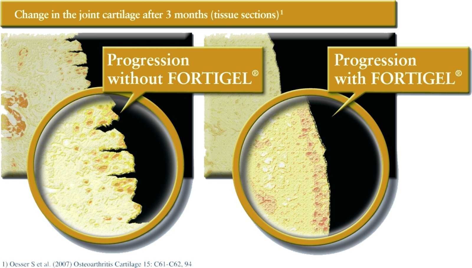 Колаген Fortigel Фортигел