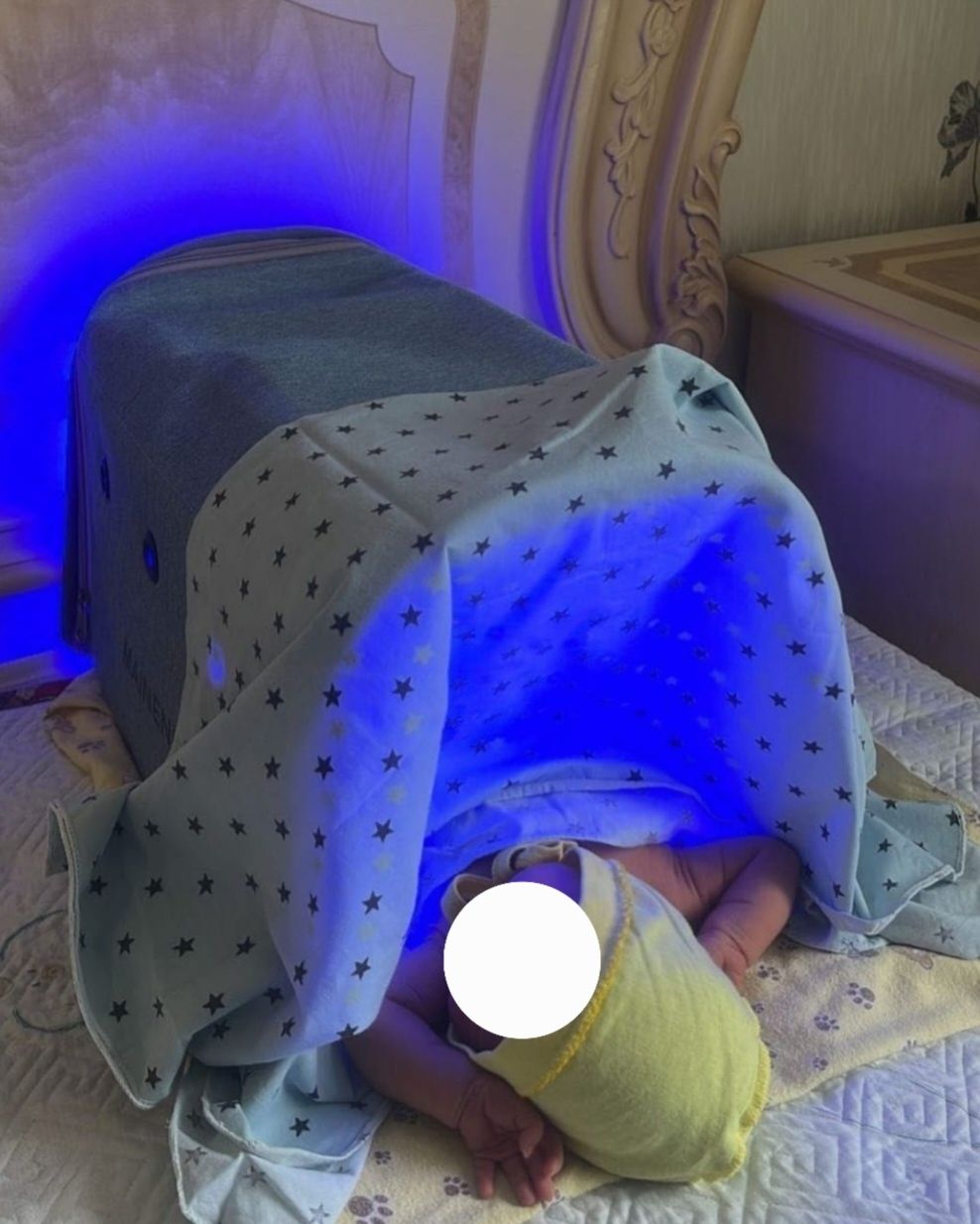 Фотолампа для лечения желтухи новорожденных. Сутки 1500тг